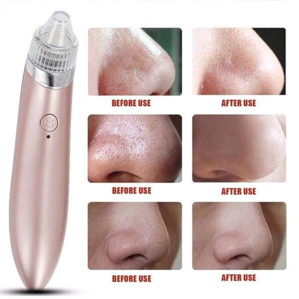 Electric Cleaner Face Blackhead Remover Multifunctional Cleaning Instrument Black Head Extractor Face Skin Care Tools - Image 4